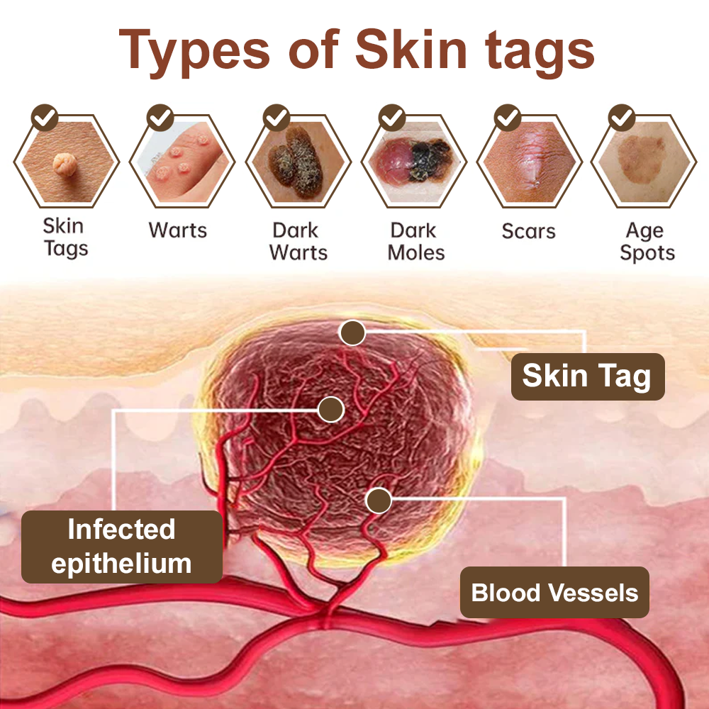 Natravor® Black Rice Skin Repair Essence Cream ⚕️ FDA Certified (Removes warts and skin growths, improves keratin buildup and seborrheic dermatitis, follicular keratosis, age spots, and bruising)