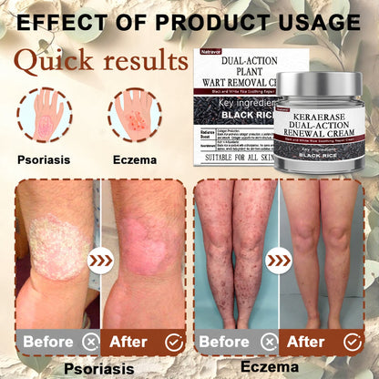 Natravor® Black Rice Skin Repair Essence Cream ⚕️ FDA Certified (Removes warts and skin growths, improves keratin buildup and seborrheic dermatitis, follicular keratosis, age spots, and bruising)